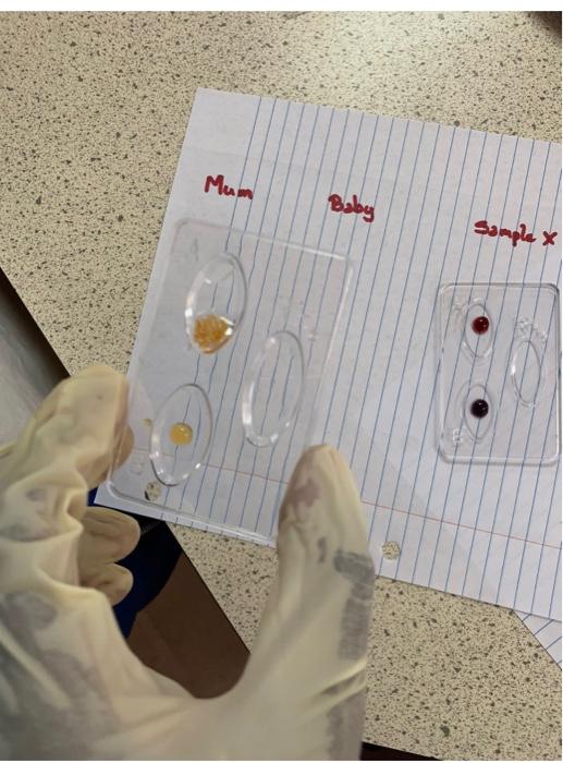 Solved due in an hour please help me use the blood sample si | Chegg.com