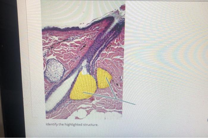 Solved Identify the highlighted structure, | Chegg.com