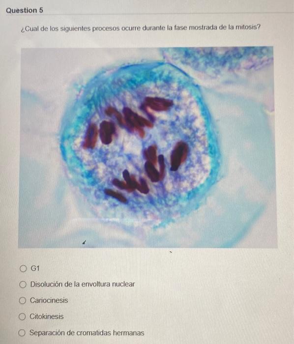 ¿Cual de los siguientes procesos ocurre durante la fase mostrada de la mitosis? G1 Disolución de la envoltura nuclear Carioci