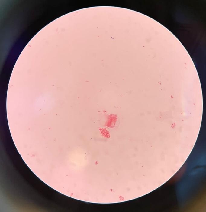 Part A. Examination of bacterial endospore by