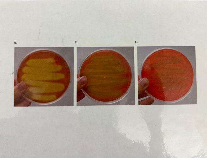 Solved B.Hemolysis Observations From Photographs On The Side | Chegg.com