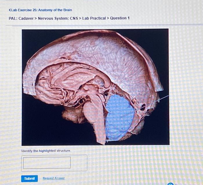 Solved Nervous System CNS > Quiz > Question 19 Which