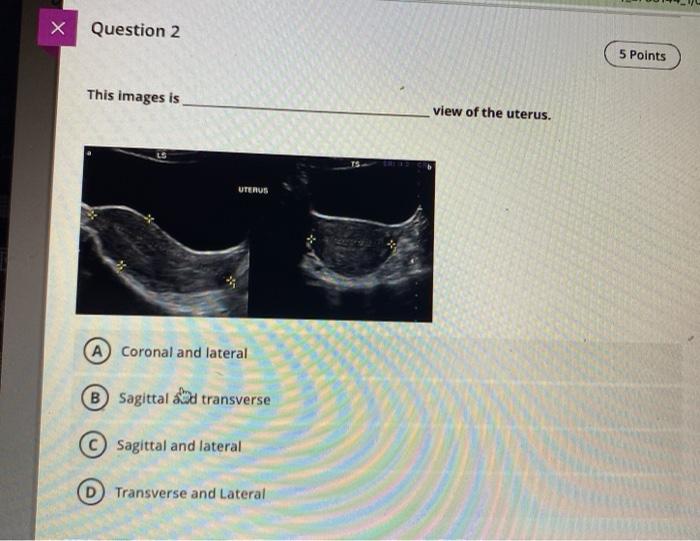 Solved H Question 2 5 Points This Images Is View Of The Chegg Com