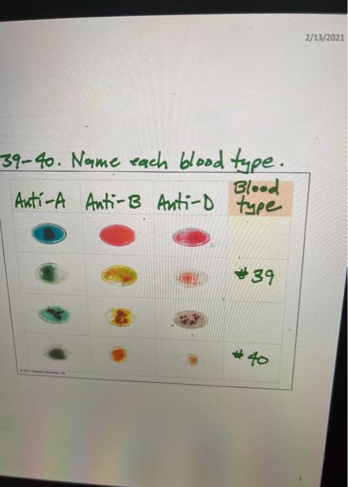 Solved 2/13/2021 29-30. Name Each Blood Type. Anti-A Anti-ß | Chegg.com