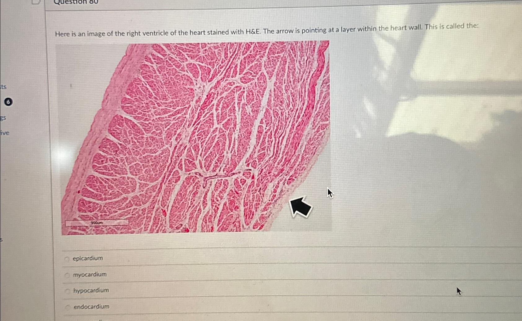Histological and Histometric Characterization of Myocardial Fibrosis in  End-Stage Hypertrophic Cardiomyopathy | Circulation: Heart Failure, image size:1685x1038