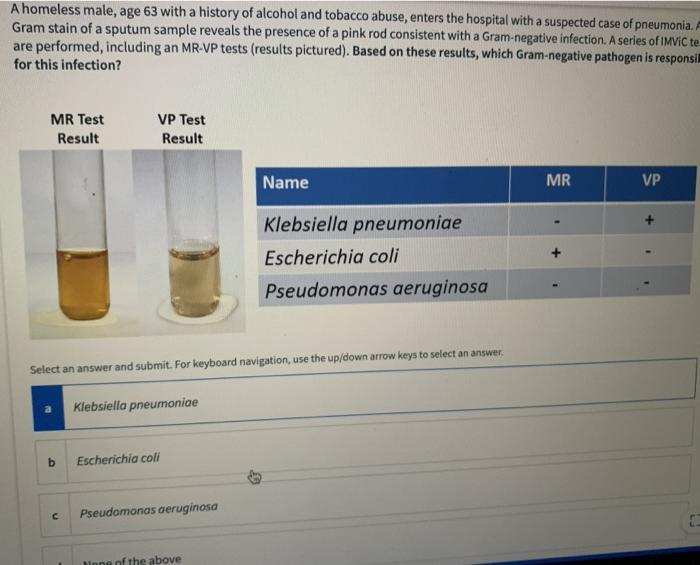 chemical composition of tobacco Chemical constituents of tobacco plant (Adapted from Down, 2014)