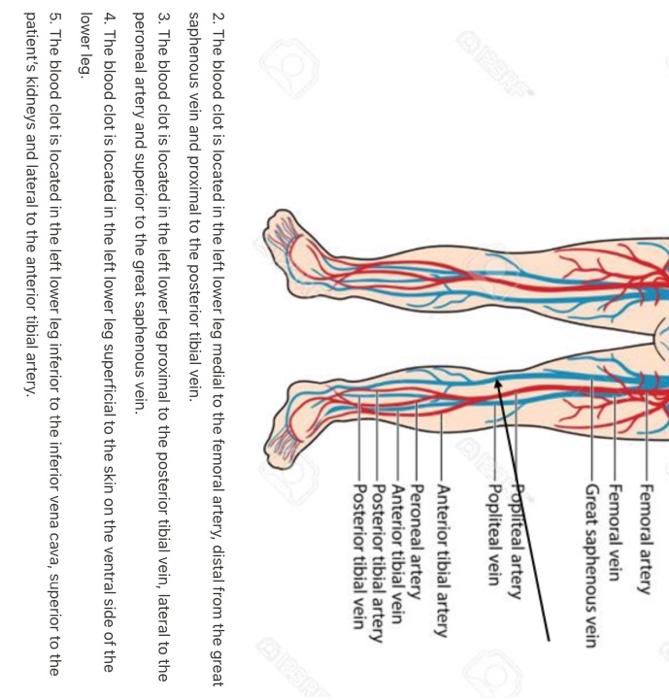 2. The blood clot is located in the left lower leg medial to the femoral artery, distal from the great saphenous vein and pro