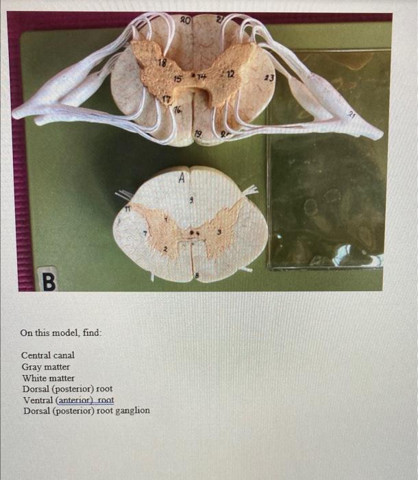 B On this model, find: Central canal Gray matter White matter Dorsal (posterior) root Ventral (anterior) root Dorsal (posteri