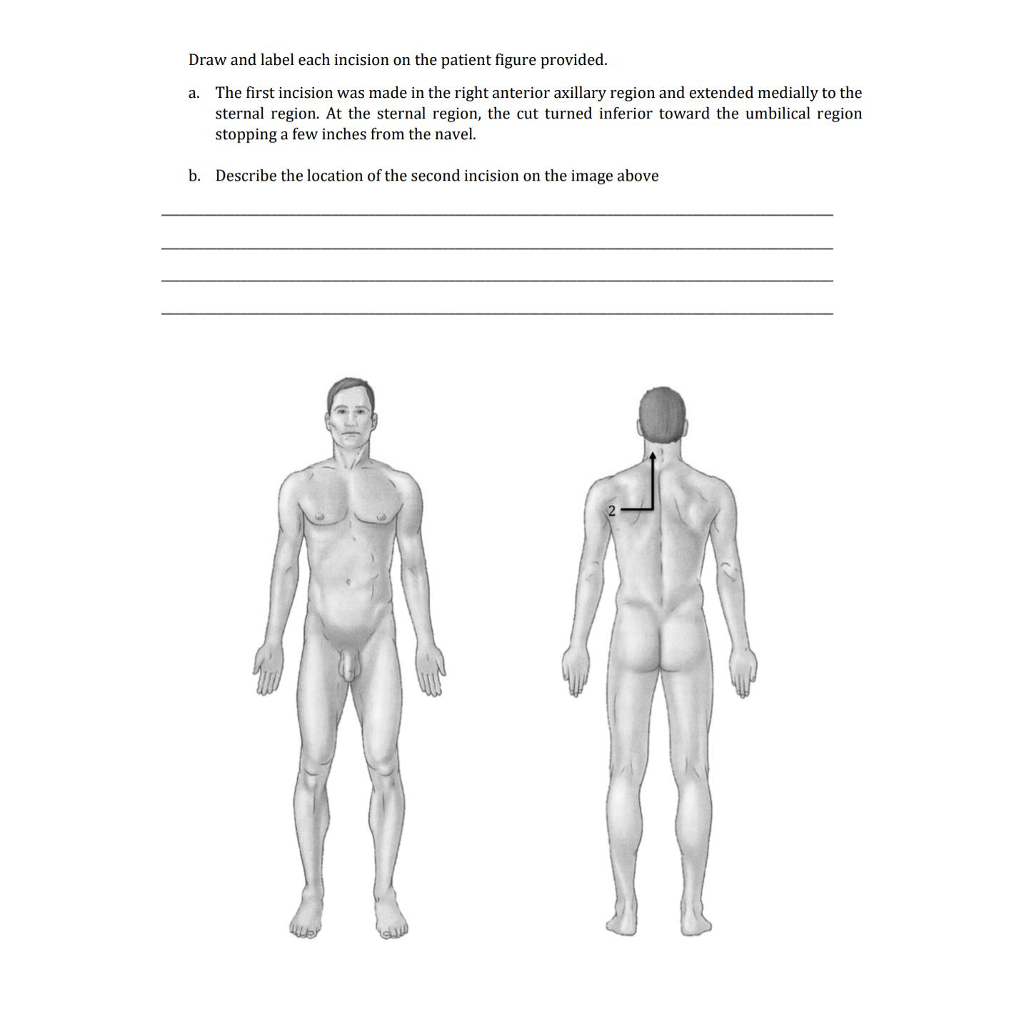 Draw and label each incision on the patient figure | Chegg.com