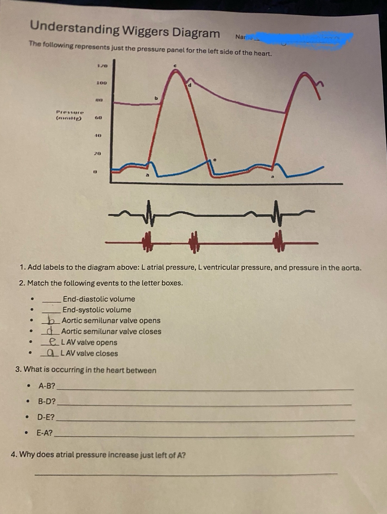 Solved Understanding Wiggers DiagramNaricThe following