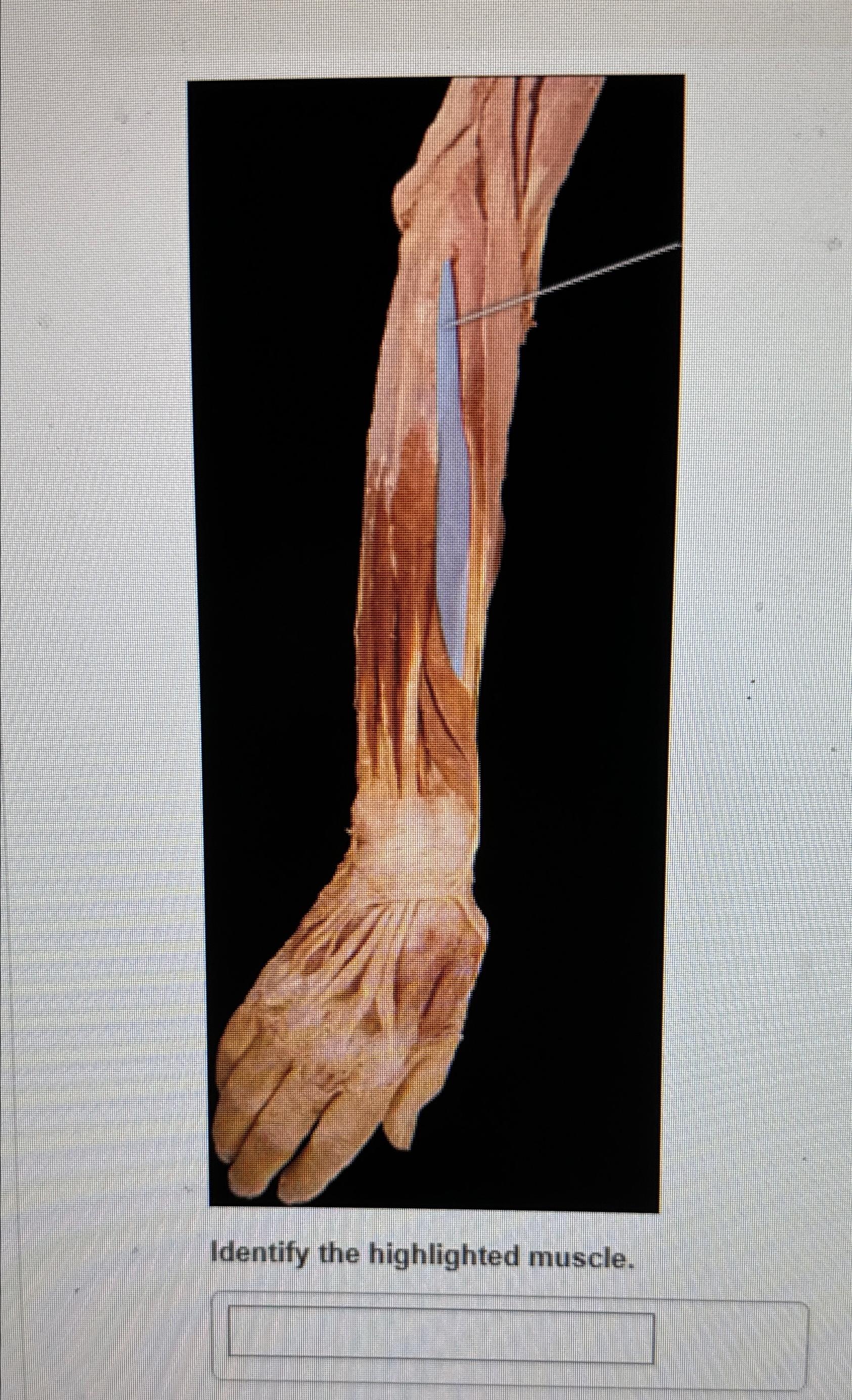 Solved Identify the highlighted muscle. | Chegg.com