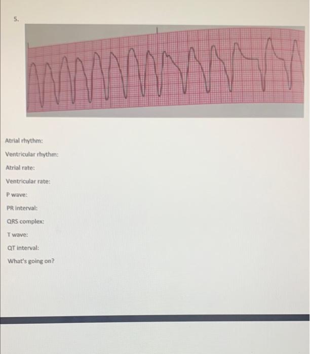 Solved 5. Atrial rhythm: Ventricular rhythm: Atrial rate: | Chegg.com