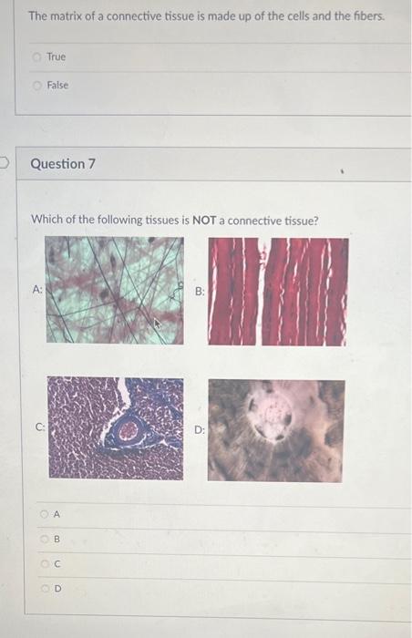 Solved All connective tissue fibers are made of which type | Chegg.com