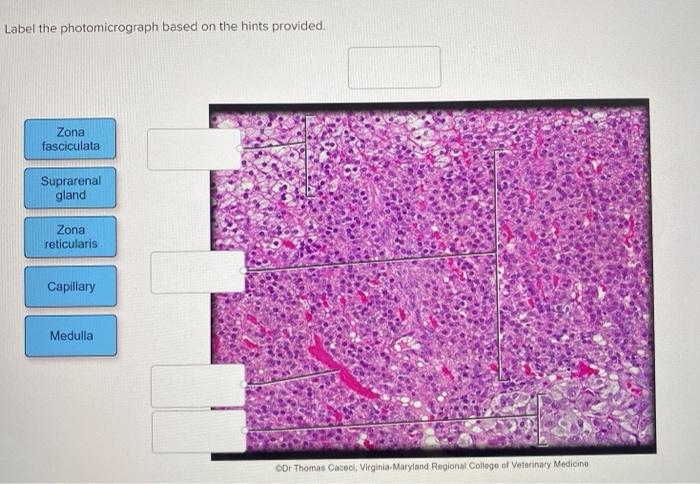 Solved Label the photomicrograph based on the hints provided | Chegg.com
