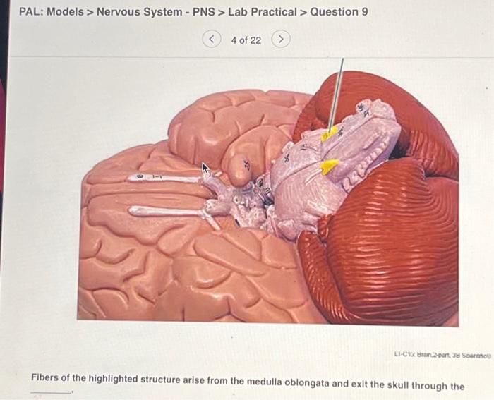 Solved PAL: Models > Nervous System - PNS > Lab Practical > | Chegg.com