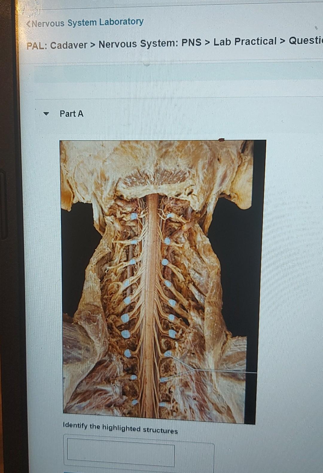 Solved «nervous System Laboratory Pal Cadaver Nervous