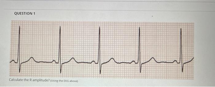 Solved QUESTION 1 Calculate the R amplitude? (Using the EKG | Chegg.com