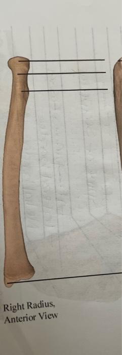 Solved Right Radius Anterior View | Chegg.com