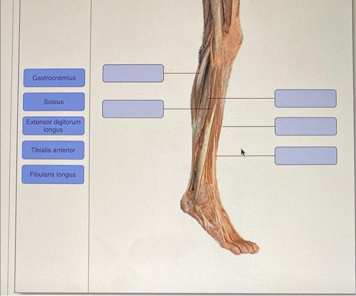 Solved Gastrocnemius II Soleus Extensor digitorum longus IND | Chegg.com