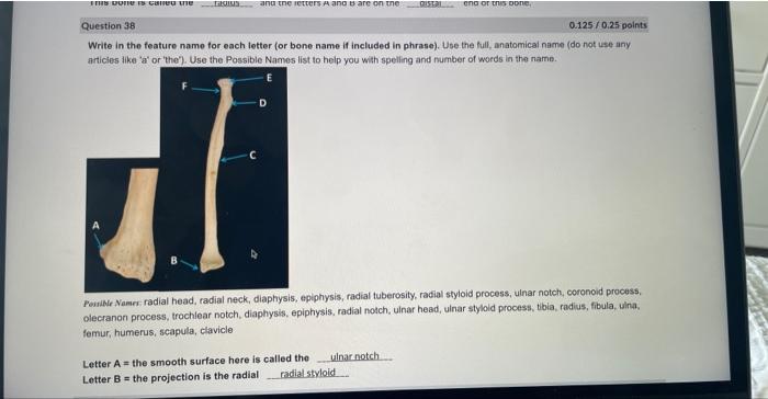 Solved Write in the feature name for each letter (or bone | Chegg.com