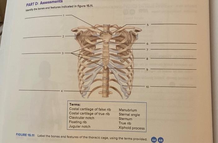 Solved PART D: Assessments Identify the bones and features | Chegg.com