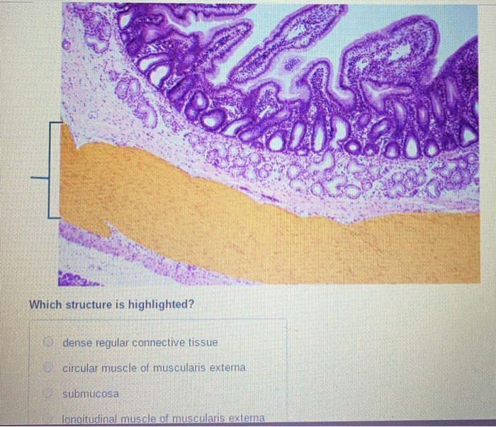 Solved Which structure is highlighted? dense regular | Chegg.com