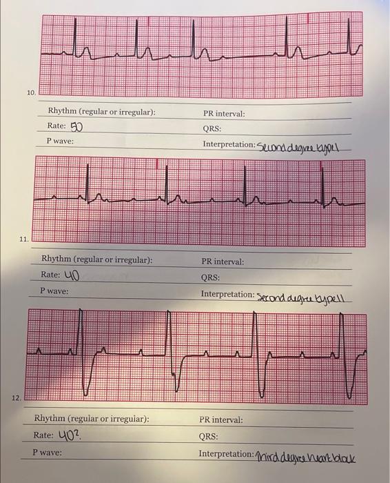 solved-10-pr-interval-rhythm-regular-or-irregular-rate-chegg