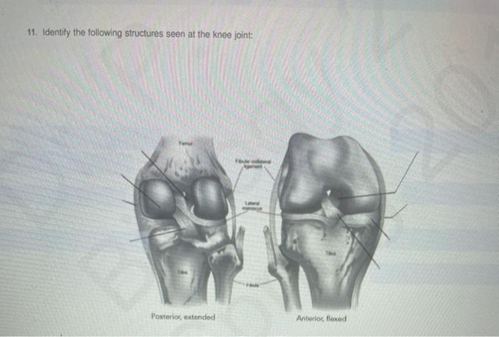 Solved 11. Identify the following structures seen at the | Chegg.com ...