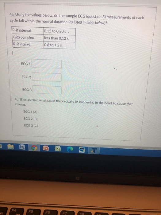 Solved 4a. Using the values below, do the sample ECG | Chegg.com