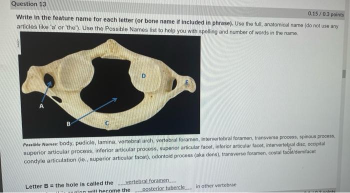 Solved Write in the bone name for each letter. Use the full, | Chegg.com