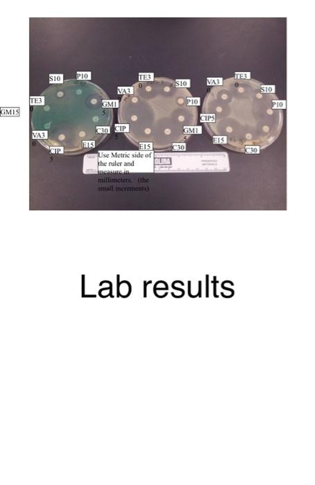 Solved Antimicrobial Susceptibility Testing (Kirby-Bauer | Chegg.com