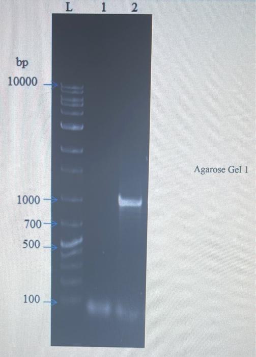 Solved 6. Using The Agarose Gel 1 Diagram, Approximate The | Chegg.com