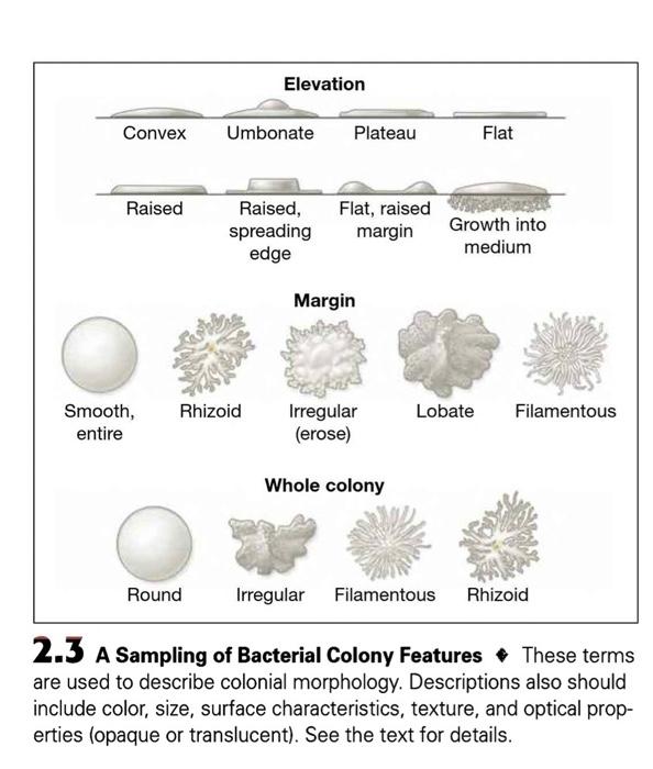 the-texture-of-serratia-marcescens-can-best-be-described-as