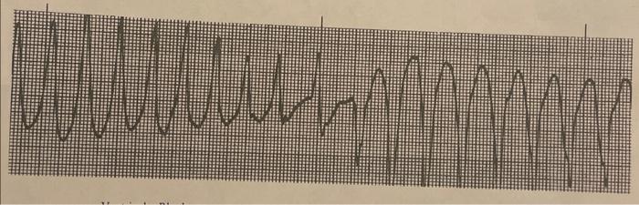 Solved what us the ecg interpretation of this strip | Chegg.com