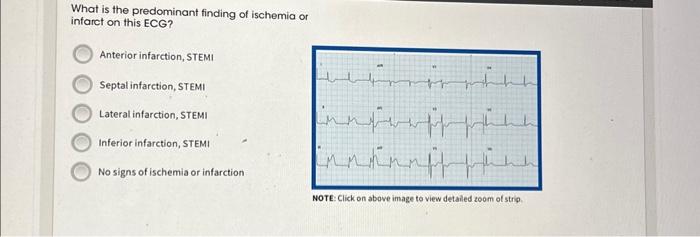 Solved What is the predominant finding of ischemia or | Chegg.com