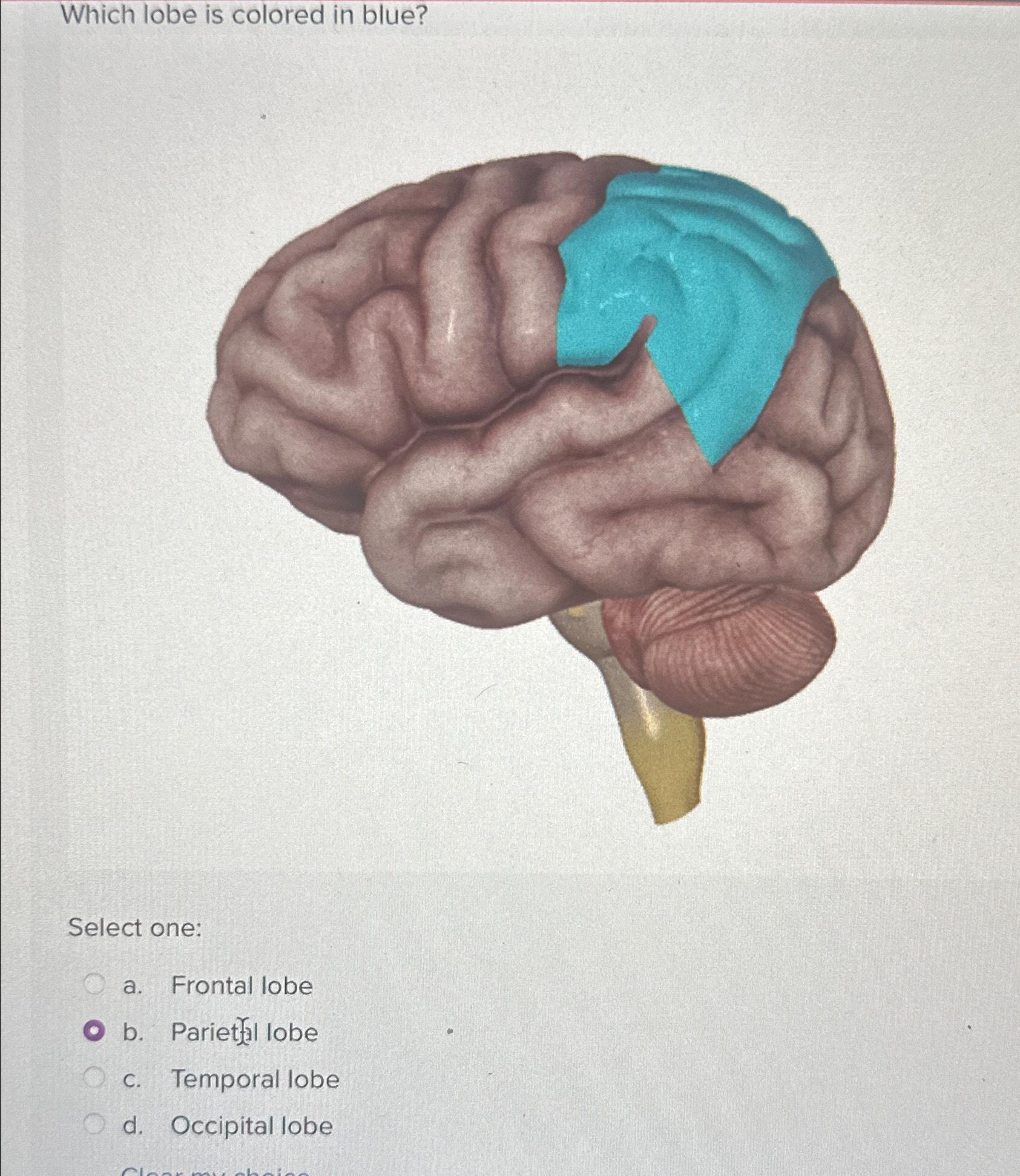 Solved Which lobe is colored in blue?Select one:a. ﻿Frontal | Chegg.com