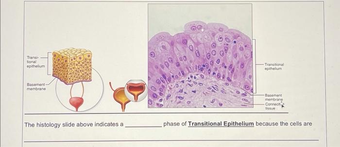 Solved Trans tional epithelium Transitional epithelium | Chegg.com