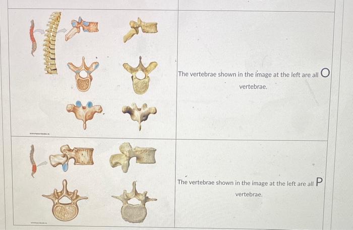 Solved A B 臺 C H D E Part B: Identify the following | Chegg.com