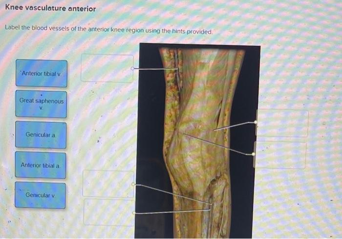 Solved Knee vasculature anterior Label the blood vessels of | Chegg.com