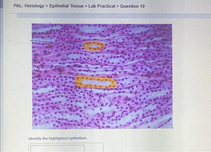 Histology Epithelial Tissue Labeled Porn Sex Picture