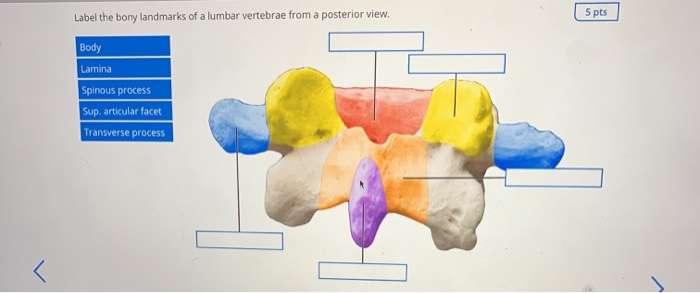 solved-label-the-bony-landmarks-of-a-lumbar-vertebrae-from-a-chegg