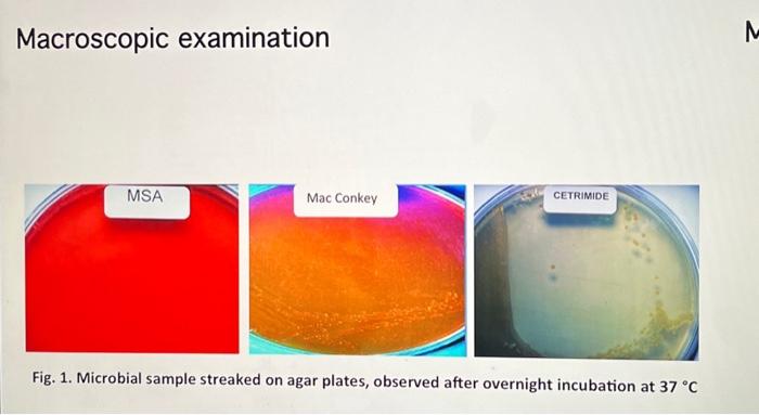 Solved Macroscopic examination Microscopic examination | Chegg.com