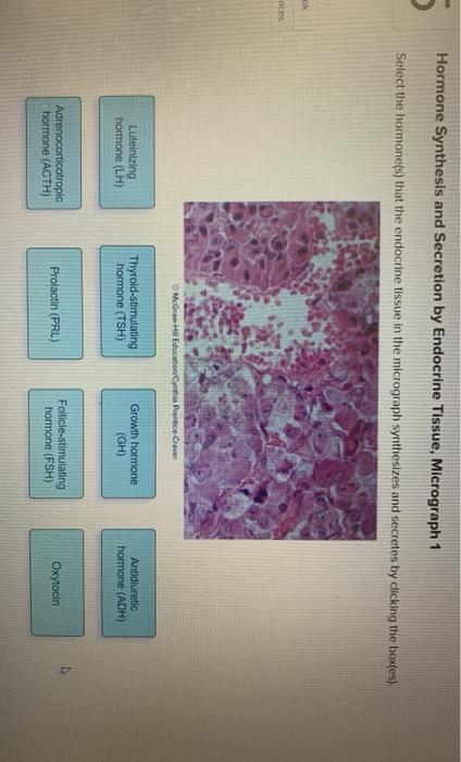 solved-hormone-synthesis-and-secretion-by-endocrine-tissue-chegg