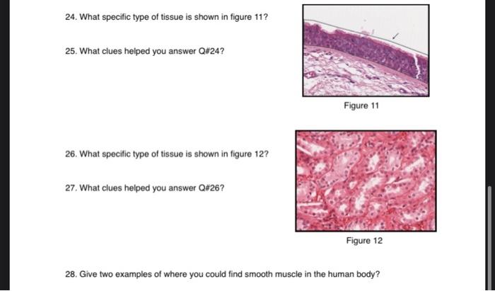 Solved 24. What specific type of tissue is shown in figure | Chegg.com