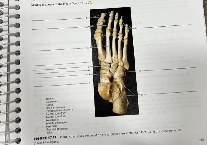 Solved Identify −2. Lamen of the foot in figure 17.11. | Chegg.com