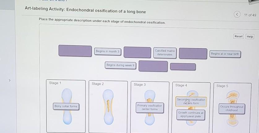 Solved Art Labeling Activity Endochondral Ossification O Chegg Com