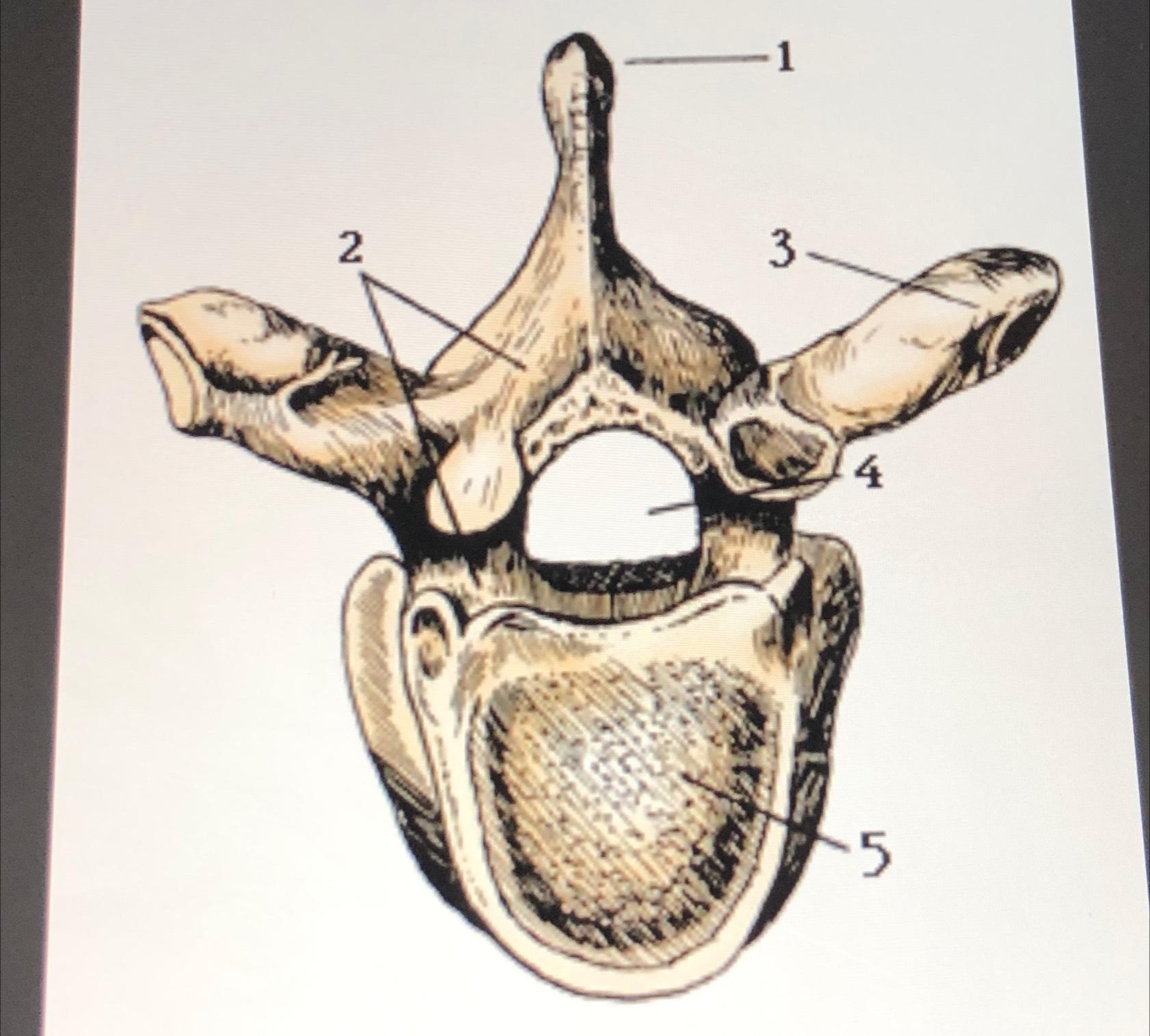 Solved Label this diagram of the vertebrae correctly 1-5 | Chegg.com