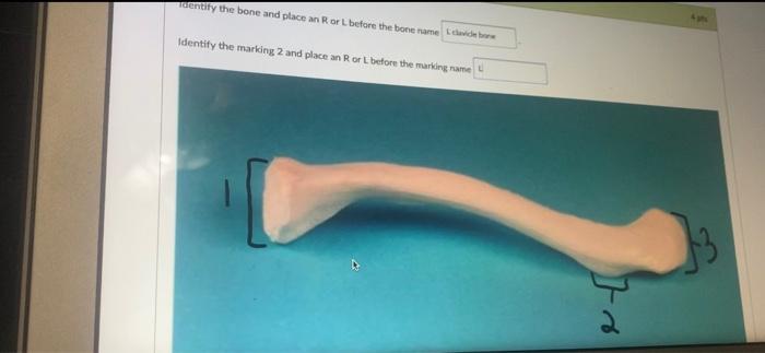 Solved raerity the bone and place an R or L before the bone | Chegg.com