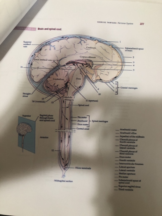 Solved EXERCISE TITLES and spinal cord Superior Cerebrum | Chegg.com