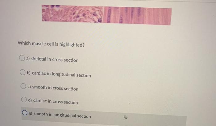 solved-which-structure-is-highlighted-a-cardiac-muscle-chegg